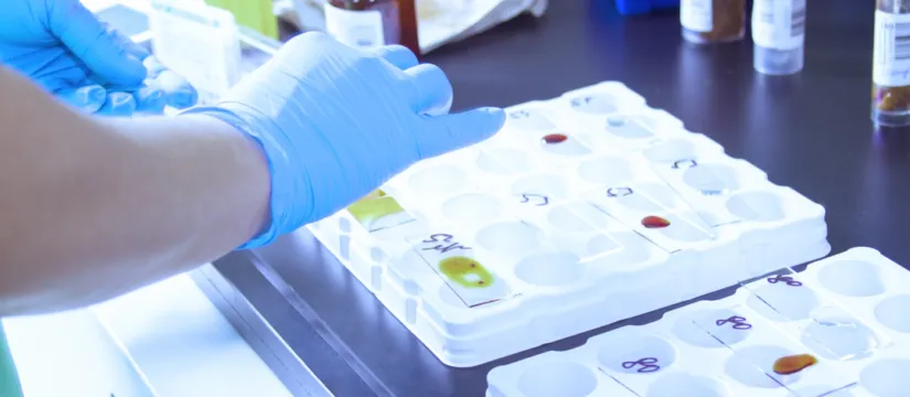 Todo sobre el Grado Superior de Anatomía Patológica y Citodiagnóstico